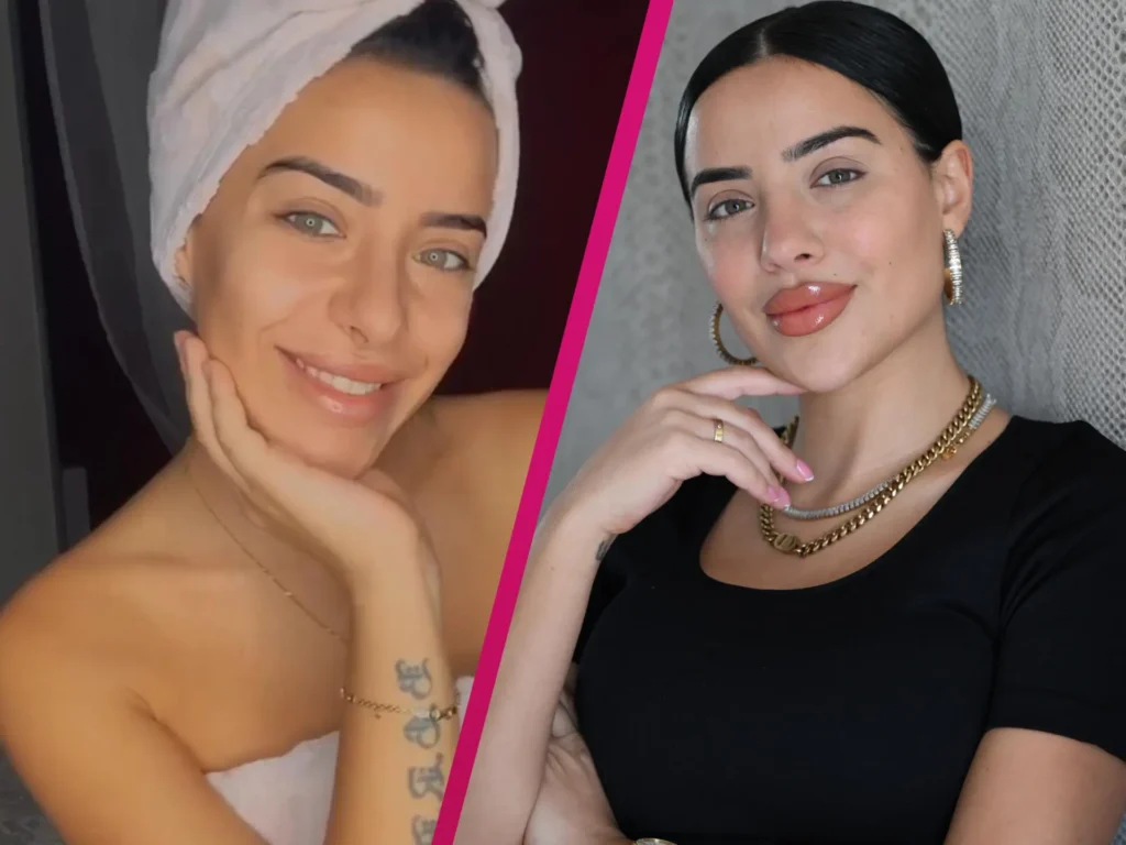 Leyla Lahouar Nase: Alles über ihre Nase und die Spekulationen um mögliche Schönheitsoperationen Leyla Lahouar Nase